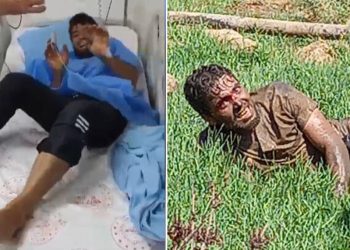 Şanlıurfa’da tedavi gören kuduz hastası hayatını kaybetti