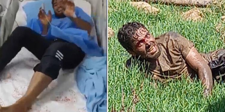 Şanlıurfa’da tedavi gören kuduz hastası hayatını kaybetti