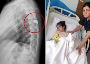 Site bahçesinde oynayan çocuğun sırtına yorgun mermi isabet etti