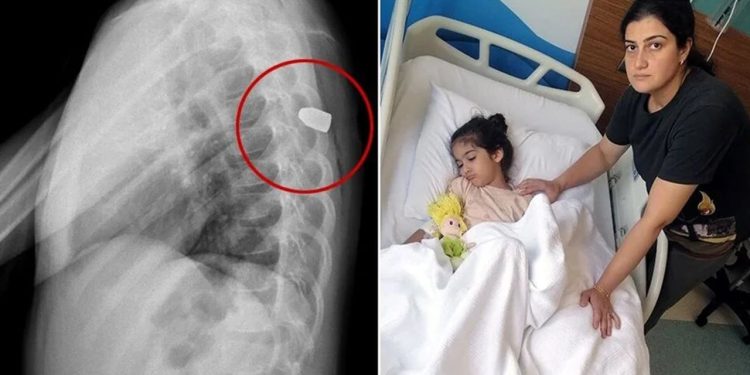 Site bahçesinde oynayan çocuğun sırtına yorgun mermi isabet etti