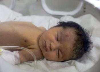 Suriye'de enkaz altında doğan bebek altı ay sonra görüntülendi: Amcası evlat edinmişti