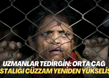 Uzmanlar tedirgin: Orta Çağ hastalığı cüzzam yeniden yükselişte