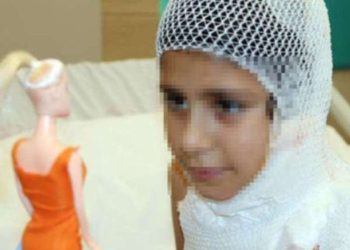 Video çekmek isterken kendini yaktı! Uzmanlardan ailelere uyarı