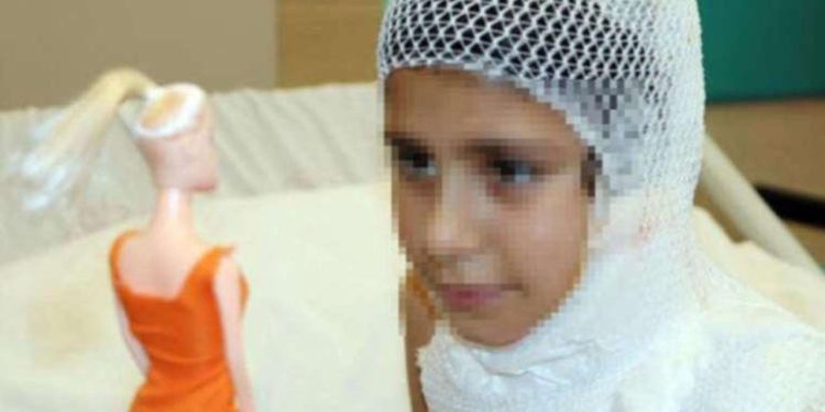 Video çekmek isterken kendini yaktı! Uzmanlardan ailelere uyarı