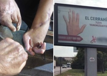 9 işçi elini 1 işçi hayatını kaybetti; iş güvenliği yerine fabrikanın girişine el cerrahisi reklamı kondu