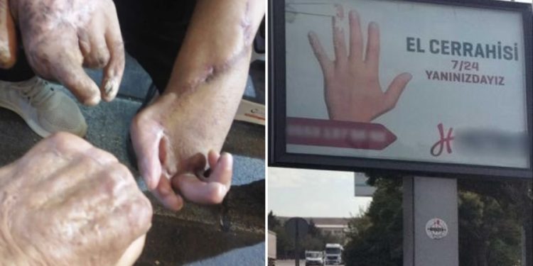 9 işçi elini 1 işçi hayatını kaybetti; iş güvenliği yerine fabrikanın girişine el cerrahisi reklamı kondu