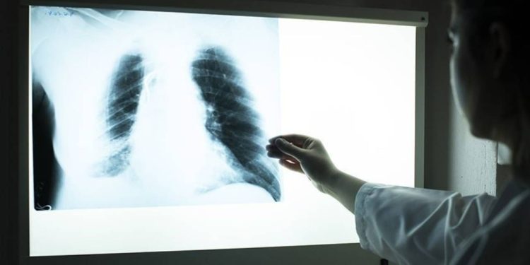 Araştırma: Koronavirüs sadece akciğer değil beyin dahil diğer organlarda da kalıcı hasar bıraktı