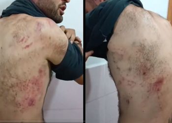 Jandarma Karakolu’nda işkence iddiası; şüpheli, yürüyemeyecek hale getirilmiş!