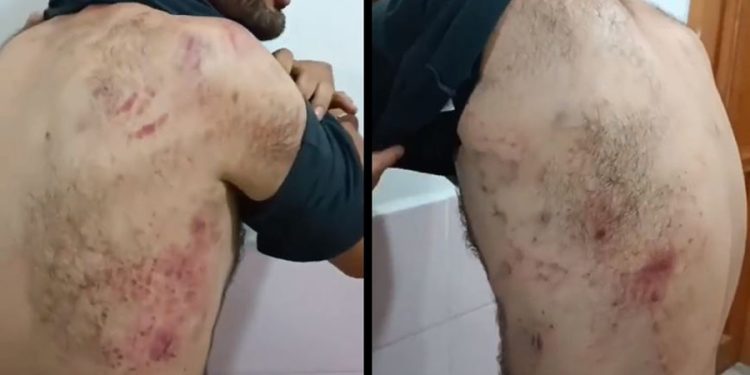 Jandarma Karakolu’nda işkence iddiası; şüpheli, yürüyemeyecek hale getirilmiş!