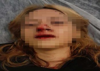 Kitap almaya giden kız öğrenciyi önce taciz ettiler, sonra kaldırım taşıyla saldırdılar, yardıma gelenin kulağını kestiler