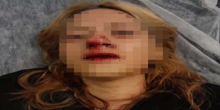 Kitap almaya giden kız öğrenciyi önce taciz ettiler, sonra kaldırım taşıyla saldırdılar, yardıma gelenin kulağını kestiler