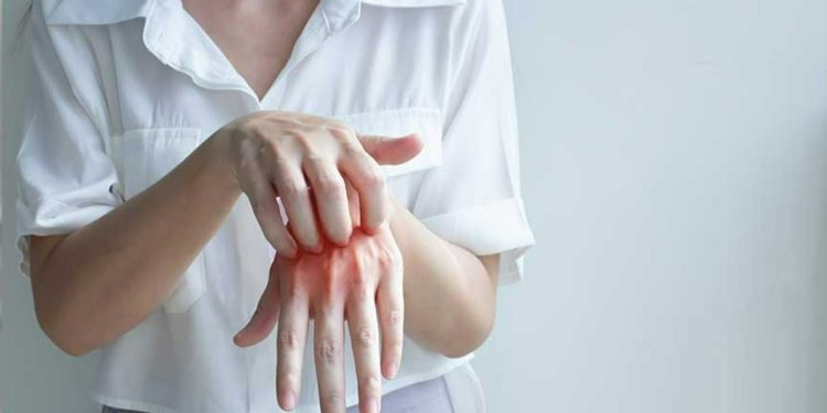 Türkiye'de pandemiden sonra uyuz vakalığı yüzde 50 arttı