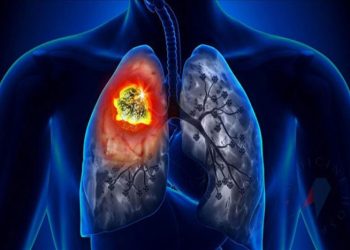 Yeni akciğer kanseri aşısı ölümleri yarı yarıya azaltacak