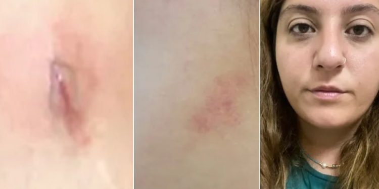 Yunanistan’a sığınan Ceren Züleyha Aybay’a işkence ve taciz