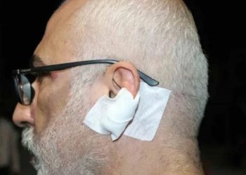 DFG gazeteci Bulut’a yönelik saldırıyı kınadı