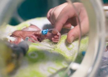 Araştırma: 2020'de yaklaşık 13,4 milyon bebek prematüre doğdu
