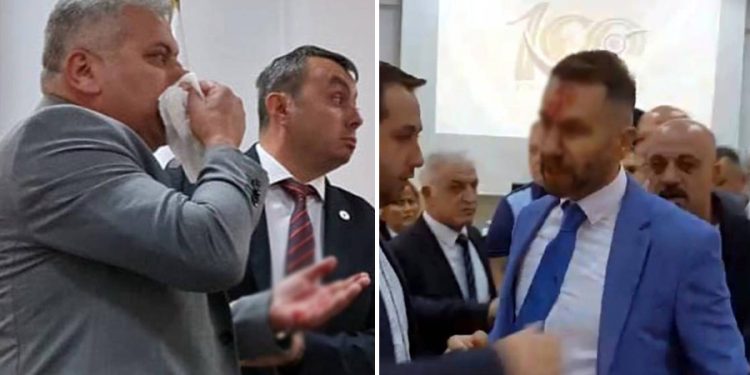Belediye Meclisi’nde kavga çıktı: MHP’li meclis üyesi, CHP’li üyenin burnunu kırdı