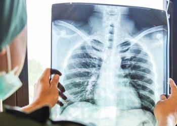 Eris varyantı için uzman uyarısı: Üç gün sonunda geçmeyen ateş, öksürük, sırt ağrısı varsa mutlaka hastaneye gidin