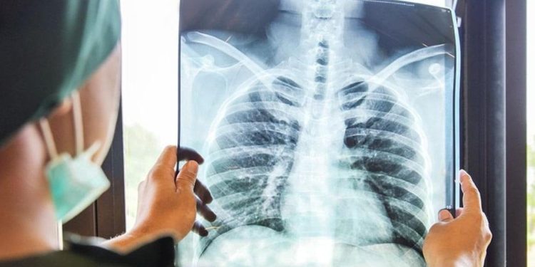 Eris varyantı için uzman uyarısı: Üç gün sonunda geçmeyen ateş, öksürük, sırt ağrısı varsa mutlaka hastaneye gidin