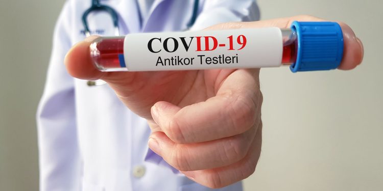 Prof. Dr. Ceyhan’dan Eris varyantı uyarısı: ‘Yapılan testlerin yarısından fazlası pozitif’