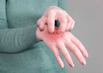 Türkiye’de uyuz vakası son 4 yılda yüzde 40 arttı