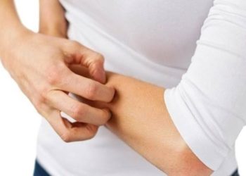 Uzmanından gece kaşıntıları için uyuz uyarısı: Son 3- 4 yılda uyuz vakaları 30- 40 kat arttı