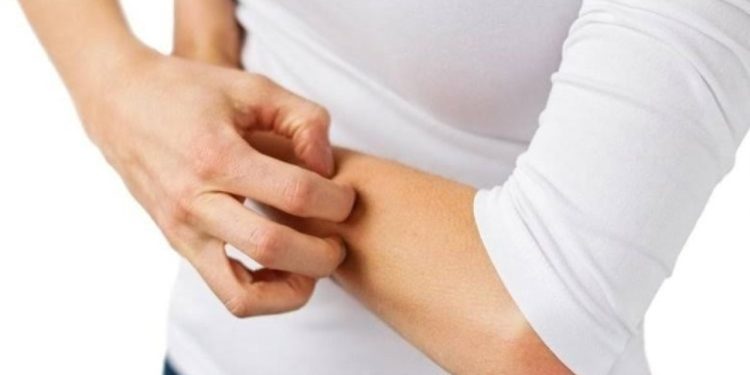 Uzmanından gece kaşıntıları için uyuz uyarısı: Son 3- 4 yılda uyuz vakaları 30- 40 kat arttı