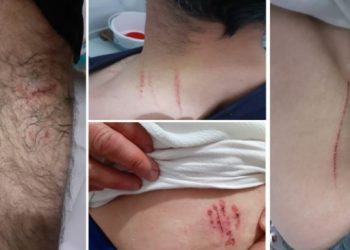 Köpekli işkence davasında ‘kusur yok’ raporu sonrası savcı beraat istedi