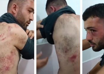 Bakanlığın işkence itirafı: Adli makamların talimatı ile gerçekleşti