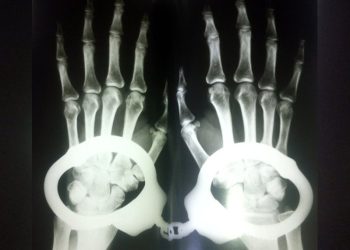 Etlik Şehir Hastanesi Başhekimliği kelepçeli muayeneyi savundu