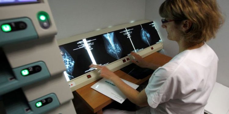 Meme kanseri riskini yüzde 50 azaltan ilaç İngiltere'de binlerce kadına 'önceden' sunulacak