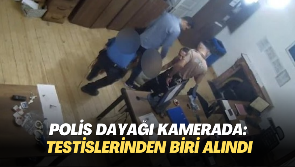 Polisin gözaltında dayağı kamerada: Şiddet yüzünden testislerinden biri alındı