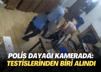 Polisin gözaltında dayağı kamerada: Şiddet yüzünden testislerinden biri alındı