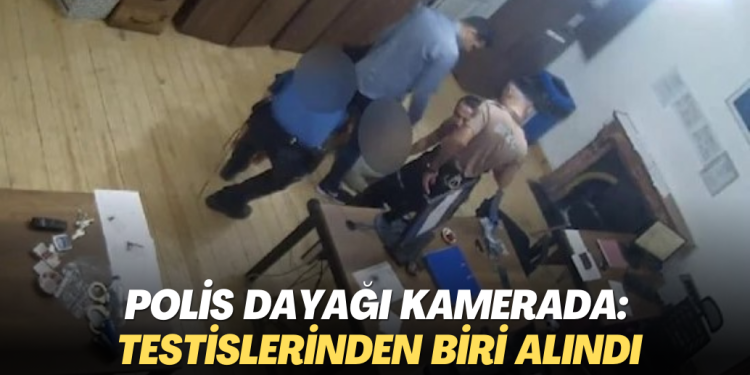 Polisin gözaltında dayağı kamerada: Şiddet yüzünden testislerinden biri alındı