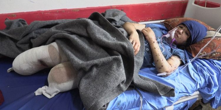 Video | İsrail bombardımanı altındaki Gazze'de ampute edilen çocuklar ve yarım kalan hayalleri