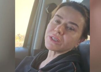 Seçil Erzan, boş bir araziye götürülüp tehdit edilmiş: Yüzündeki şişlik dikkat çekti