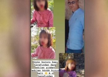 Korucubaşından 10 yaşındaki çocuğa şiddet: Dişleri kırıldı
