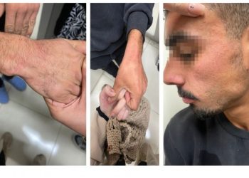 Darp edilen zihinsel engelli için ‘kovuşturmaya yer yok’ kararı