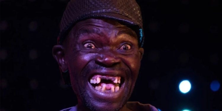 Dünyanın en çirkin insanı Maison Sere ölü bulundu