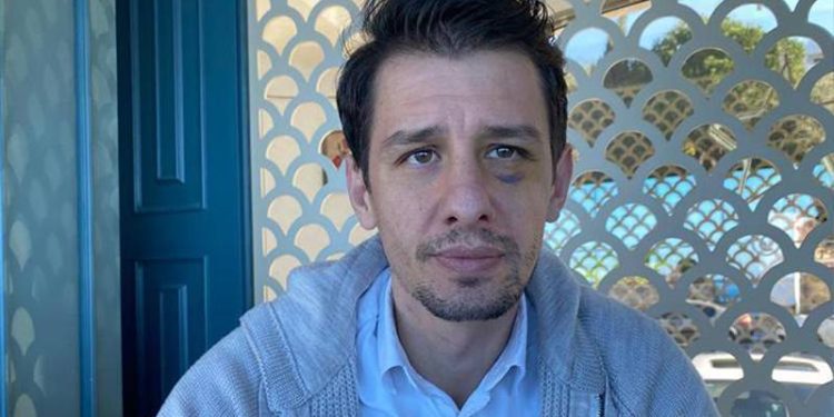 Emre Belözoğlu provoke etti, bunu öncesinde planladı