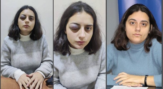 HEDEP Gençlik Meclisi sözcüsüne polis şiddeti