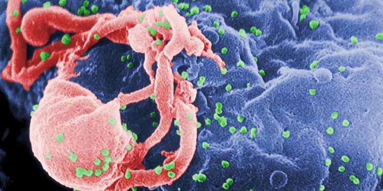 HIV tedavisinde 'kök hücre' umudu