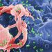 HIV tedavisinde 'kök hücre' umudu