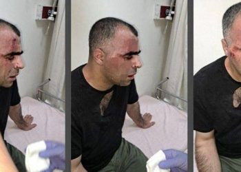 Saldırıya uğrayan gazeteciye ‘saldırganlara hakaret’ davası