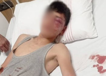 Antep’te göçmen çocuğa işkence ve cinsel istismar