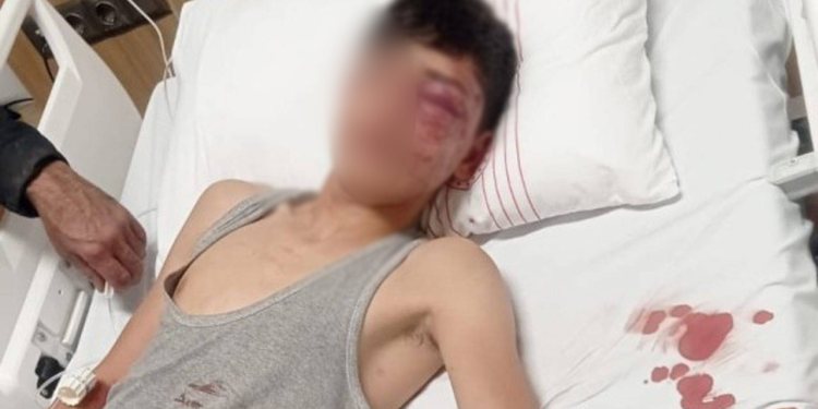 Antep’te göçmen çocuğa işkence ve cinsel istismar
