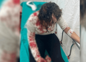 Kahramanmaraş'ta bir kadın boşandığı erkek tarafından beyzbol sopasıyla dövüldü: Kadının kafasına 30 dikiş atıldı, şiddet faili erkek serbest bırakıldı