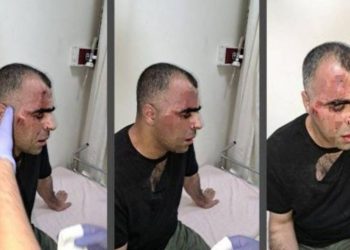 Saldırıya uğrayan gazeteciye hapis cezası