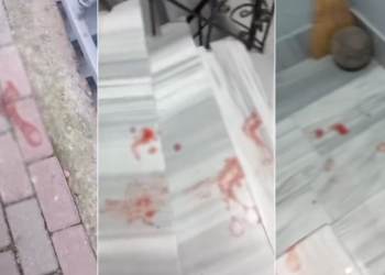 13 yaşındaki çocuk, 13 yaşındaki çocuk tarafından bıçaklandı