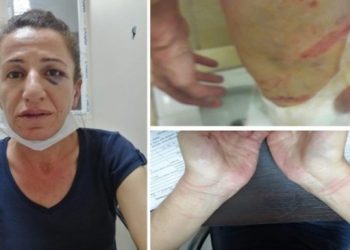 Köpekle işkence davalarında aynı tanık polis aynı ifadeler